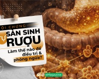 Hội chứng tự sản sinh rượu: Làm thế nào để điều trị và phòng ngừa?