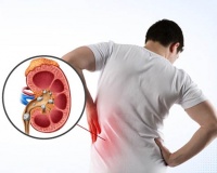 Chế độ ăn uống giúp ngăn sỏi thận tái phát