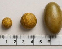 Sỏi mật 9,6mm có nguy hiểm không?