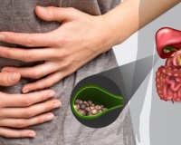 Sỏi mật gây đau bụng, đầy trướng và chậm tiêu xử trí thế nào?