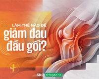 Làm thế nào để giảm đau đầu gối?