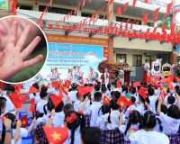 Bộ Y tế cảnh báo gia tăng bệnh tay chân miệng trong mùa tựu trường