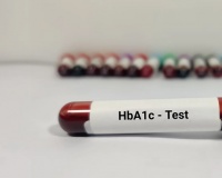 Đái tháo đường: Chỉ số HbA1c 8,9% làm cách nào để hạ?