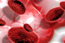 Thiếu máu bất sản: Căn bệnh hiếm vô cùng nguy hiểm 