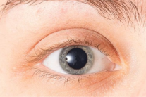 6 nguyên nhân gây giãn đồng tử 