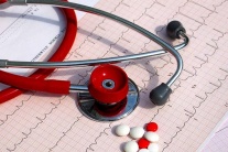 Ngoại tâm thu thất có chữa khỏi hoàn toàn được không? 