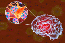 Bệnh não mô cầu xâm lấn: Tối ưu hóa dự phòng căn bệnh gây 'tử vong 24h'