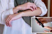 Tại sao người bệnh đái tháo đường thường hay bị nhiễm trùng da?