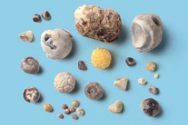 Có nhiều viên sỏi mật 9 - 11mm dùng TPBVSK Kim Đởm Khang được không?