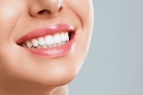 Chuyên gia nha khoa chia sẻ về tình trạng rạn men răng