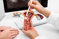 Sau mổ u xơ tử cung cần lưu ý gì?