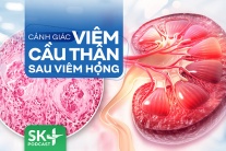 Podcast: Cảnh giác viêm cầu thận sau viêm họng