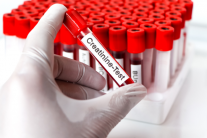 Làm thế nào để ổn định nồng độ creatinine ở bệnh nhân suy thận?
