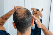 Nam giới bị rụng tóc nên ngừng loại đồ uống nào?