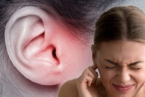 Béo phì có thể làm tăng nguy cơ mắc chứng ù tai?