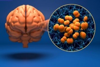 Hà Nội phát hiện ca mắc bệnh não mô cầu thứ 3 trong năm 