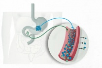 Đừng bỏ qua các dấu hiệu cảnh báo sớm bệnh đái tháo đường type 2!
