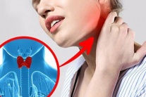 “Điểm mặt” dấu hiệu cảnh báo bệnh tuyến giáp