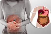 Sỏi bùn túi mật 17mm dùng TPBVSK Kim Đởm Khang được không?