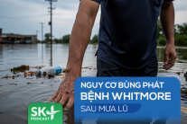 Podcast: Nguy cơ bùng phát bệnh Whitmore sau mưa lũ