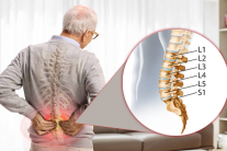 Dấu hiệu nhận biết thoái hóa đốt sống lưng L5 S1 không nên bỏ qua