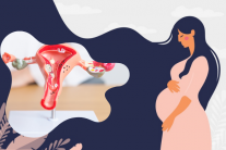 Bị nhân xơ tử cung có thai được không?