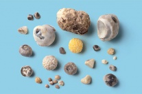 Sỏi mật 7mm: Dùng TPBVSK Kim Đởm Khang được không?