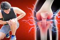 “Thủ phạm” gây đau khớp gối ở tuổi 30