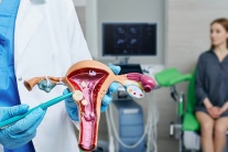 Mối liên hệ giữa u xơ tử cung và bệnh tim mạch ở phụ nữ