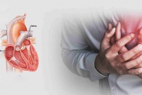 Hẹp van tim do thấp tim: Nguy cơ tiềm ẩn ở người trẻ