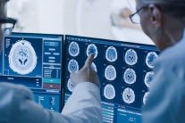 Thói quen có thể giúp “trẻ hóa” não bộ