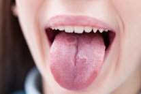 Thủ phạm “quen mặt” tăng nguy cơ ung thư miệng lên 50%