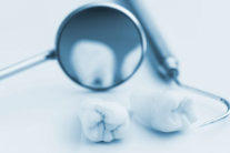 4 thói quen không nên làm trước buổi khám nha khoa