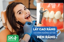 Podcast: Lấy cao răng có gây ảnh hưởng gì tới men răng không?