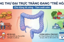 Khi nào người trẻ cần đi tầm soát ung thư đại trực tràng?