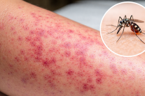 Bộ Y tế: Nguy cơ gia tăng dịch bệnh dịp sát Tết