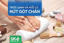 Podcast: Trời lạnh và nỗi lo nứt gót chân