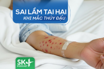 Podcast: Sai lầm tai hại khi mắc thủy đậu  