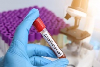 Tại sao chỉ số creatinin lúc tăng lúc giảm?