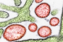 Nhật Bản: Chuẩn bị thử nghiệm lâm sàng vaccine ngừa virus Nipah