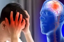 Tai biến mạch máu não có mấy loại?