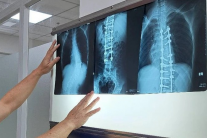 Chụp X-quang không đủ 6 phút bị từ chối thanh toán BHYT, Bộ Y tế vào cuộc