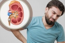 Vì sao nam giới dễ bị sỏi thận hơn nữ giới?
