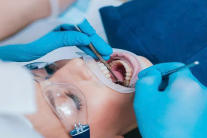 WHO ban hành hướng dẫn mới về phòng và điều trị sâu răng