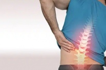 Cách giảm đau lưng do thoát vị đĩa đệm L3 L4 tại nhà