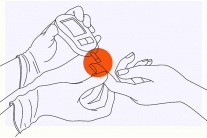 Chỉ số HbA1C 6,3% đã cần điều trị bằng thuốc chưa?