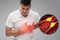 Lầm tưởng thường gặp về cholesterol