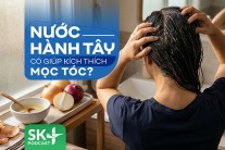 Podcast: Nước hành tây có giúp kích thích mọc tóc?