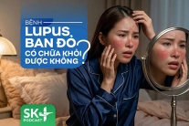Podcast: Bệnh lupus ban đỏ có chữa khỏi được không?