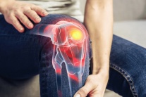 Bị thoái hóa khớp: Nên ăn và tránh thực phẩm nào?